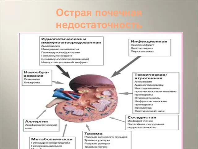 Острая почечная недостаточность