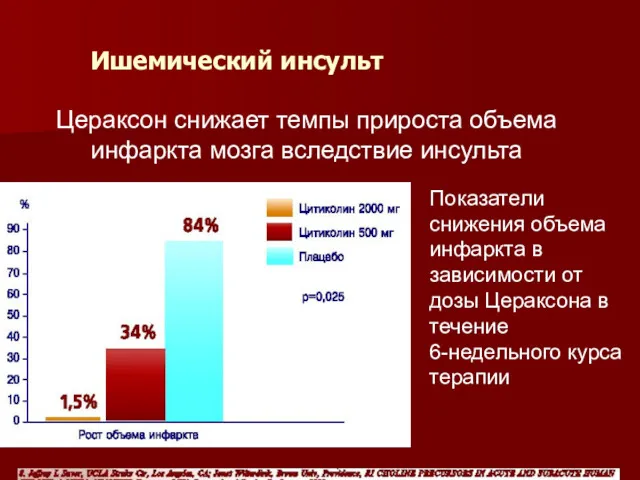 Ишемический инсульт Цераксон снижает темпы прироста объема инфаркта мозга вследствие