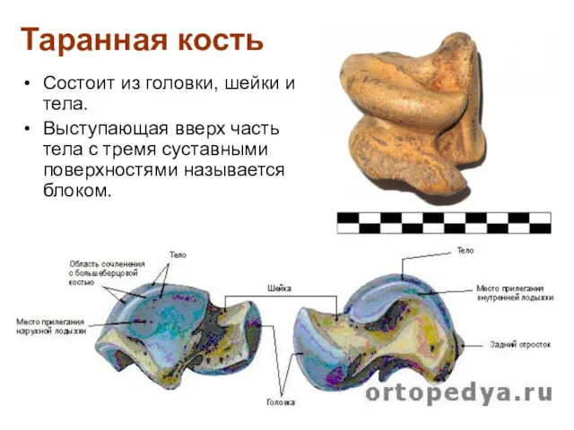 Таранная кость Состоит из головки, шейки и тела. Выступающая вверх