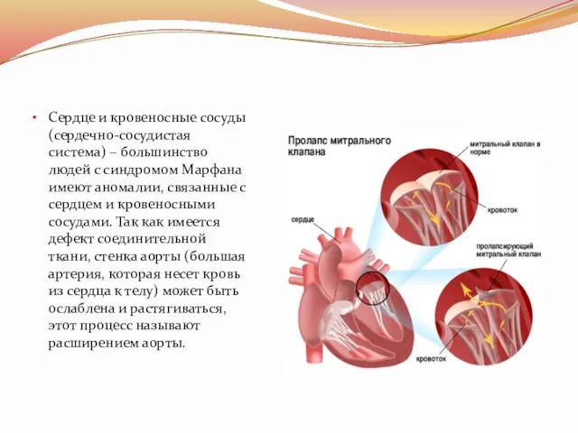 Сердце и кровеносные сосуды (сердечно-сосудистая система) – большинство людей с