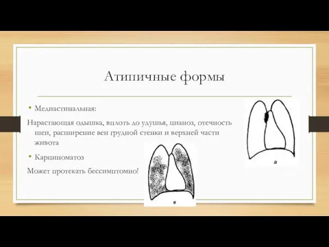 Атипичные формы Медиастинальная: Нарастающая одышка, вплоть до удушья, цианоз, отечность