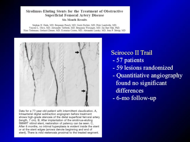 Scirocco II Trail - 57 patients - 59 lesions randomized - Quantitiative angiography