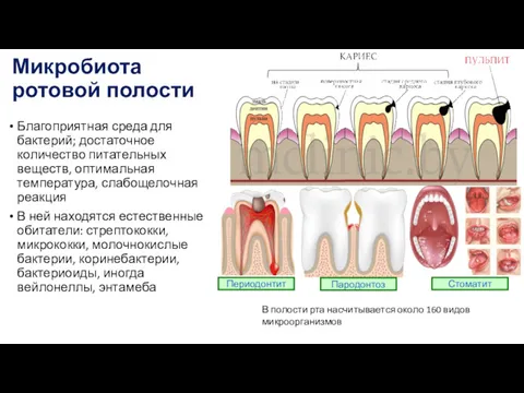 Периодонтит Пародонтоз Стоматит Микробиота ротовой полости Благоприятная среда для бактерий;