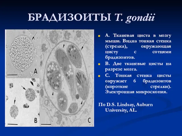 БРАДИЗОИТЫ T. gondii А. Тканевая циста в мозгу мыши. Видна тонкая стенка (стрелка),
