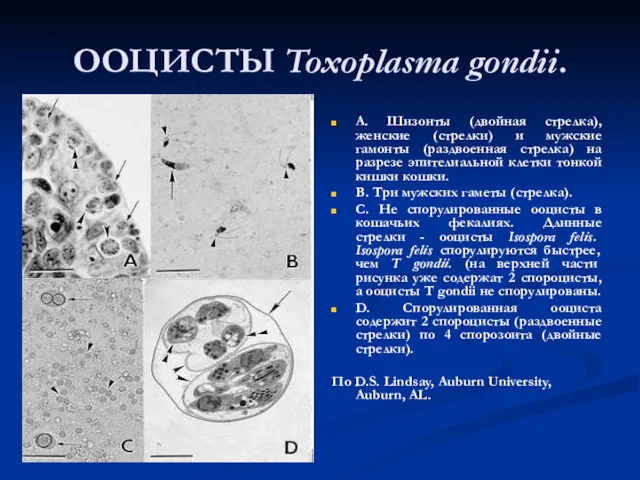 ООЦИСТЫ Toxoplasma gondii. A. Шизонты (двойная стрелка), женские (стрелки) и мужские гамонты (раздвоенная