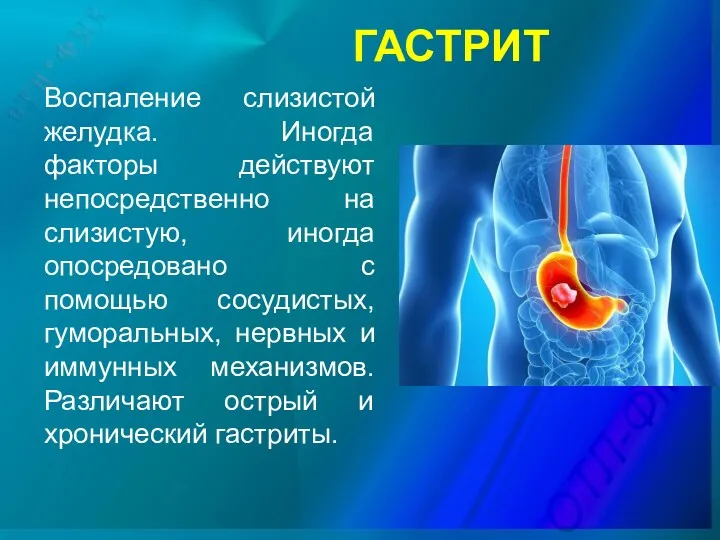 ГАСТРИТ Воспаление слизистой желудка. Иногда факторы действуют непосредственно на слизистую,