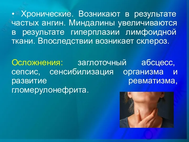 • Хронические. Возникают в результате частых ангин. Миндалины увеличиваются в