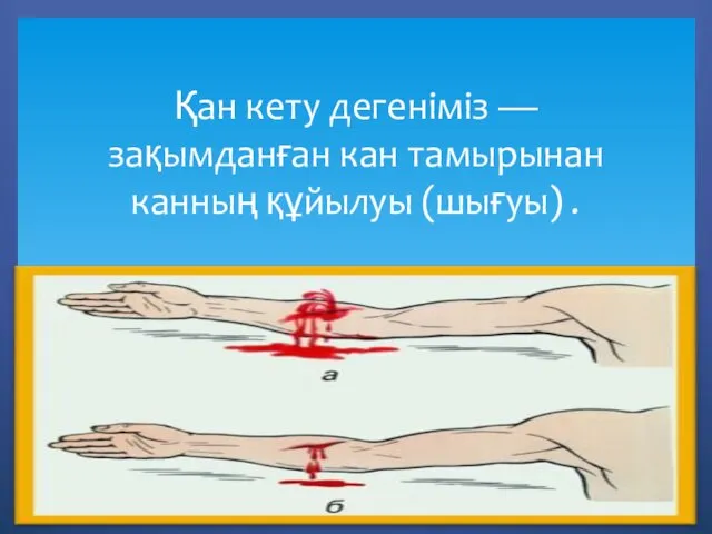 Қан кету дегеніміз — зақымданған кан тамырынан канның құйылуы (шығуы) .