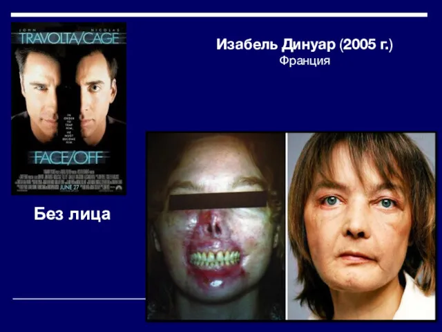 Без лица Изабель Динуар (2005 г.) Франция