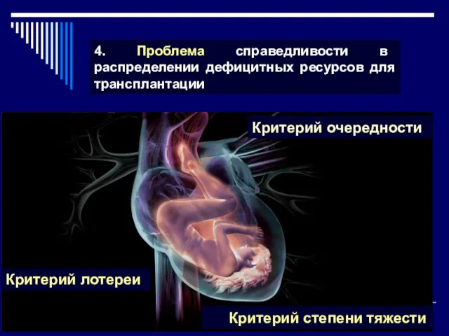 4. Проблема справедливости в распределении дефицитных ресурсов для трансплантации Критерий лотереи Критерий степени тяжести Критерий очередности