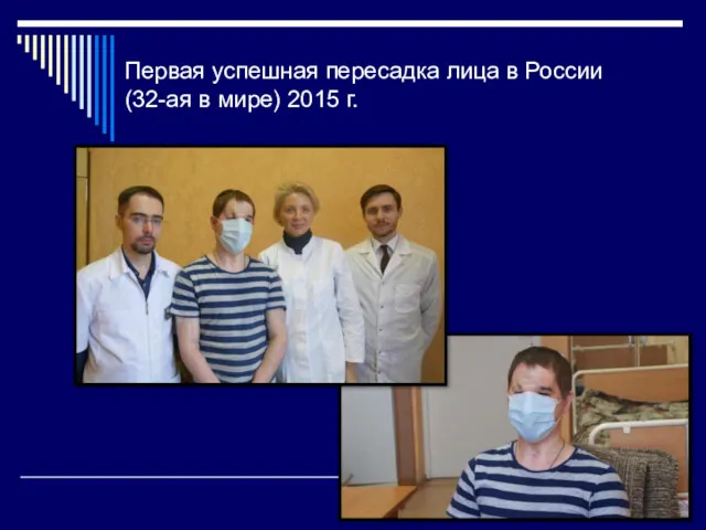 Первая успешная пересадка лица в России (32-ая в мире) 2015 г.