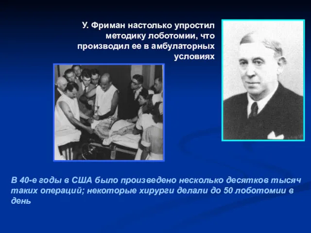 У. Фриман настолько упростил методику лоботомии, что производил ее в