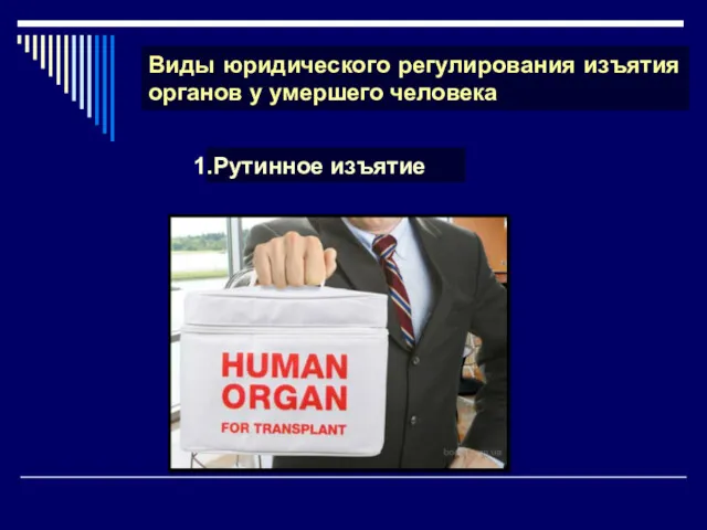 Виды юридического регулирования изъятия органов у умершего человека Рутинное изъятие