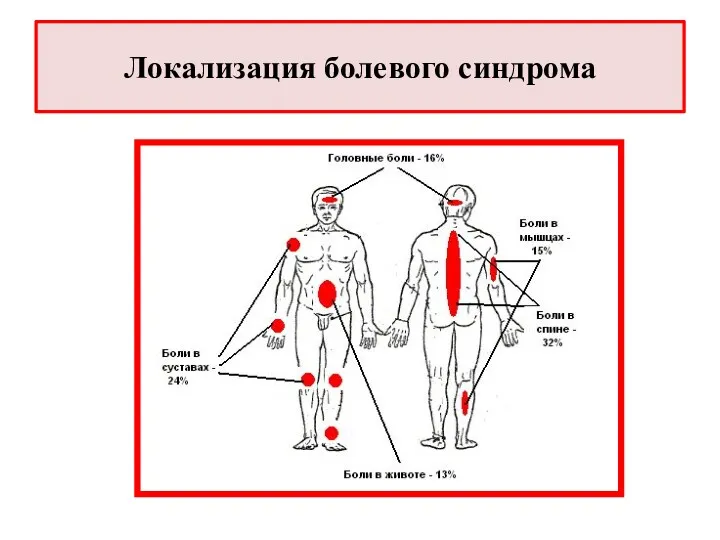 Локализация болевого синдрома