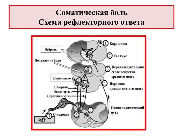 Соматическая боль Схема рефлекторного ответа