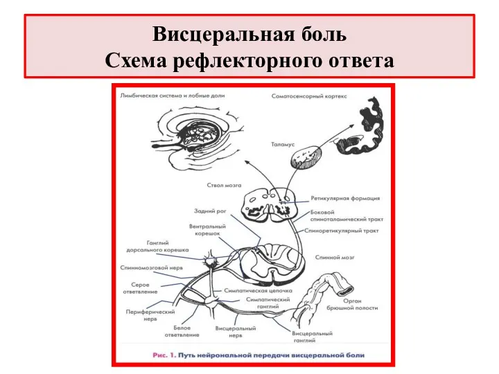 Висцеральная боль Схема рефлекторного ответа