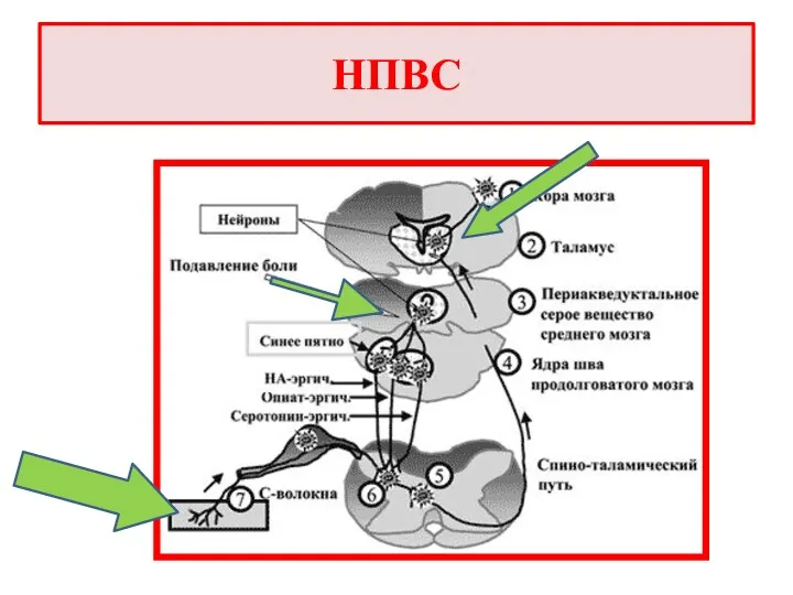 НПВС