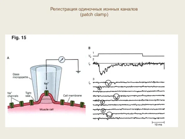 Регистрация одиночных ионных каналов (patch clamp)