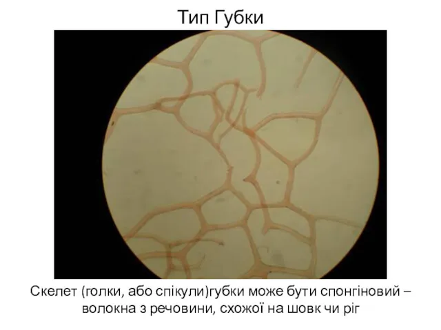 Тип Губки Скелет (голки, або спікули)губки може бути спонгіновий –