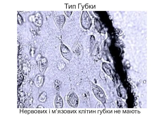 Тип Губки Нервових і м’язових клітин губки не мають