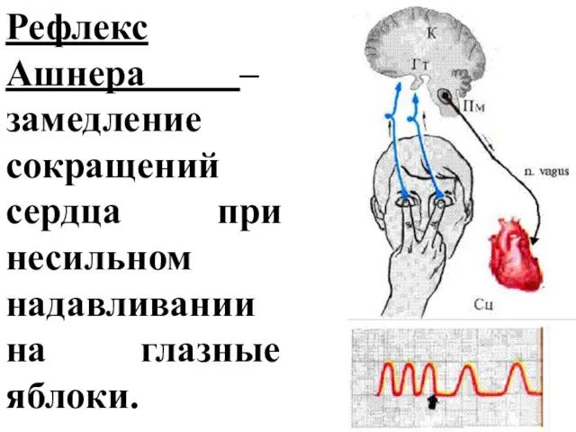 Рефлекс Ашнера – замедление сокращений сердца при несильном надавливании на глазные яблоки.