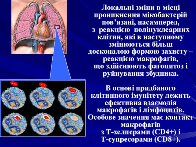 Локальні зміни в місці проникнення мікобактерій пов’язані, насамперед, з реакцією