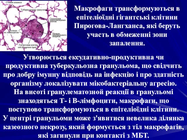 Макрофаги трансформуються в епітеліоїдні гігантські клітини Пирогова-Лангханса, які беруть участь