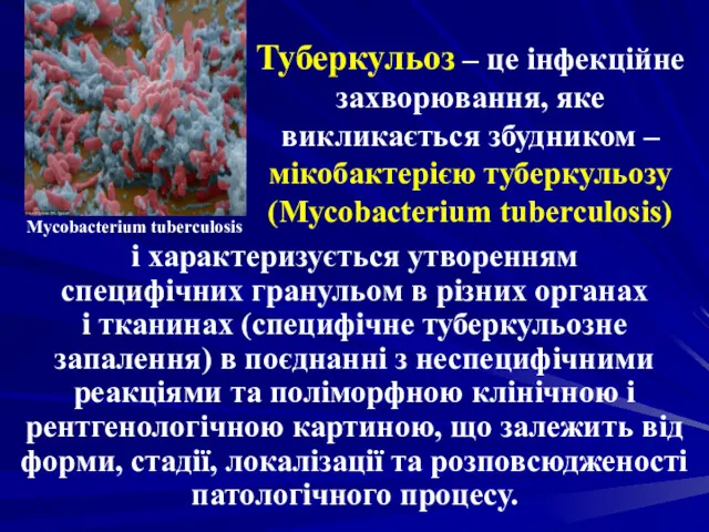 Туберкульоз – це інфекційне захворювання, яке викликається збудником – мікобактерією