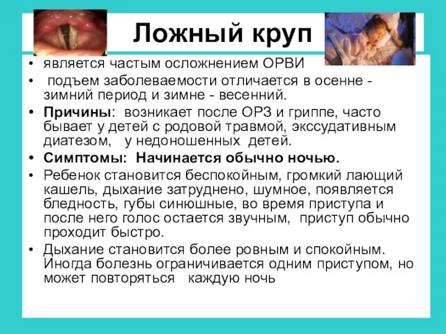 Ложный круп является частым осложнением ОРВИ подъем заболеваемости отличается в