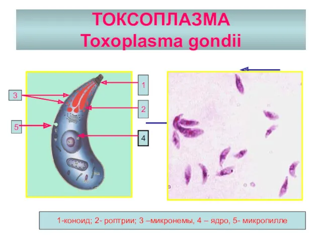 ТОКСОПЛАЗМА Toxoplasma gondii 2 3 4 1-коноид; 2- роптрии; 3