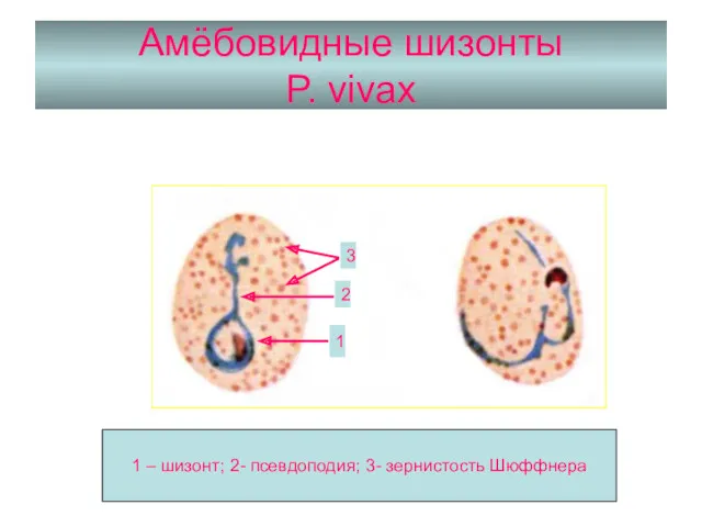 Амёбовидные шизонты P. vivax 1 2 3 1 – шизонт; 2- псевдоподия; 3- зернистость Шюффнера