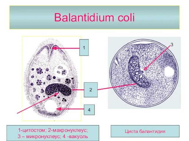 Balantidium coli 1 2 4 1-цитостом; 2-макронуклеус; 3 – микронуклеус; 4 -вакуоль Циста балантидия 3 3