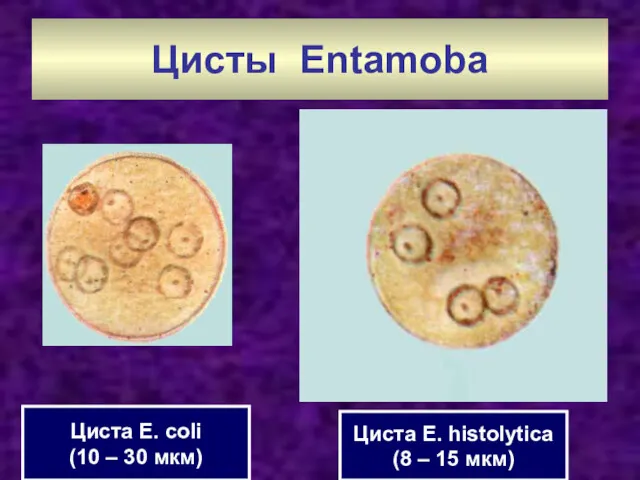 Цисты Entamoba Циста E. coli (10 – 30 мкм) Циста E. histolytica (8 – 15 мкм)