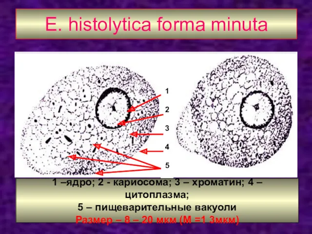 E. histolytica forma minuta 1 2 3 4 5 1