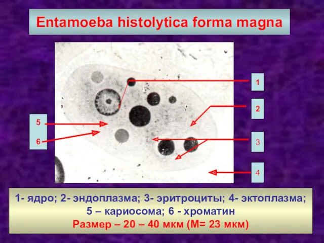 Entamoeba histolytica forma magna 1 2 3 4 1- ядро;