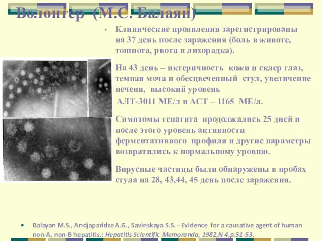 Волонтер (M.С. Балаян) Клинические проявления зарегистрированы на 37 день после