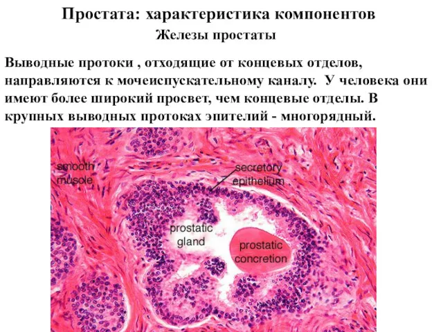 Простата: характеристика компонентов Железы простаты Выводные протоки , отходящие от