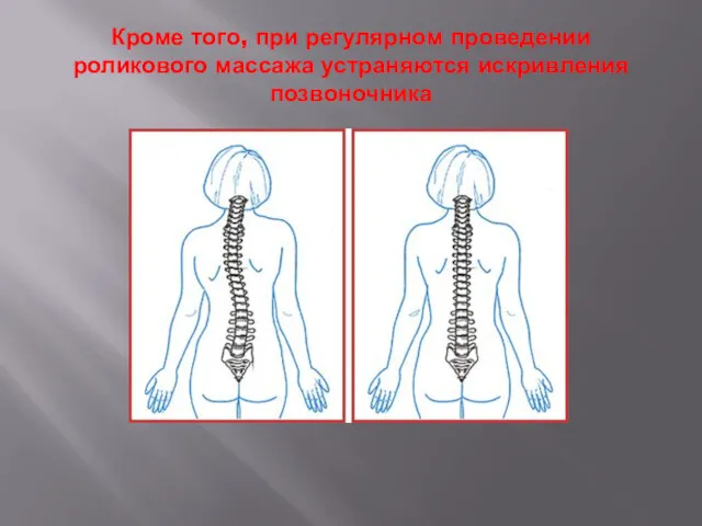 Кроме того, при регулярном проведении роликового массажа устраняются искривления позвоночника