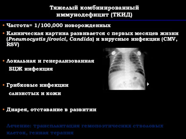 Частота= 1/100,000 новорожденных Клиническая картина развивается с первых месяцев жизни