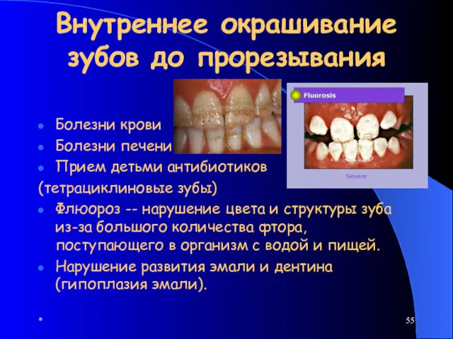 * Внутреннее окрашивание зубов до прорезывания Болезни крови Болезни печени