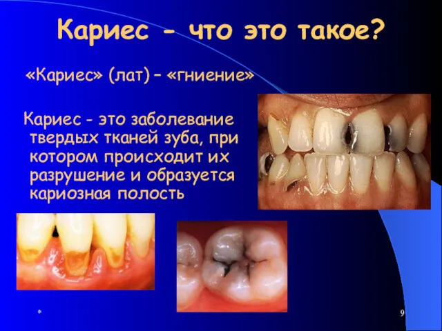 * Кариес - что это такое? «Кариес» (лат) – «гниение»