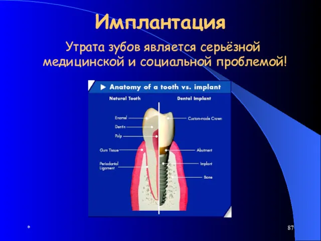 * Имплантация Утрата зубов является серьёзной медицинской и социальной проблемой!