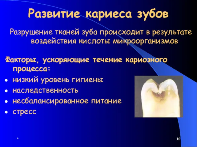 * Развитие кариеса зубов Разрушение тканей зуба происходит в результате