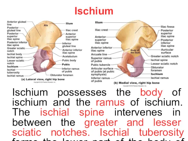 Ischium Ischium possesses the body of ischium and the ramus