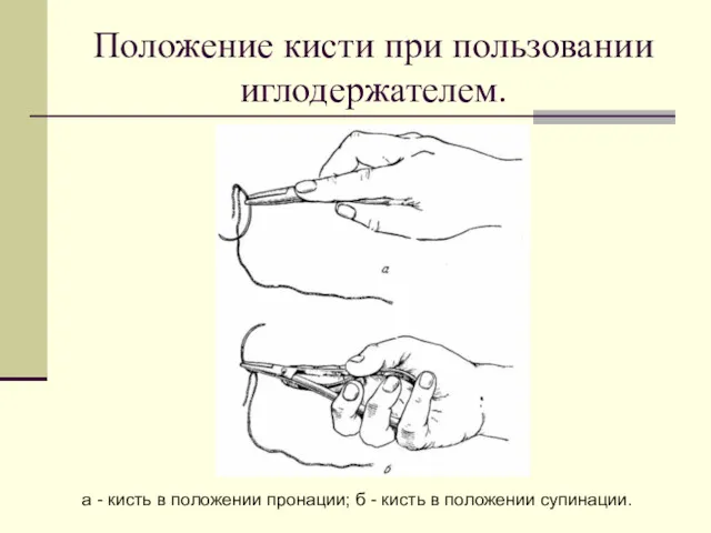 Положение кисти при пользовании иглодержателем. а - кисть в положении