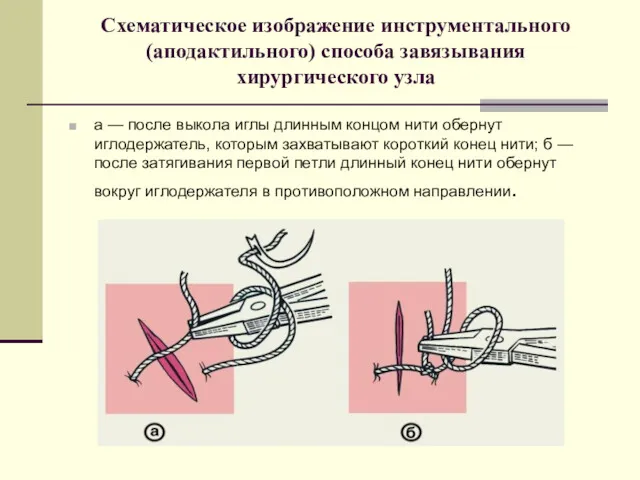 Схематическое изображение инструментального (аподактильного) способа завязывания хирургического узла а —