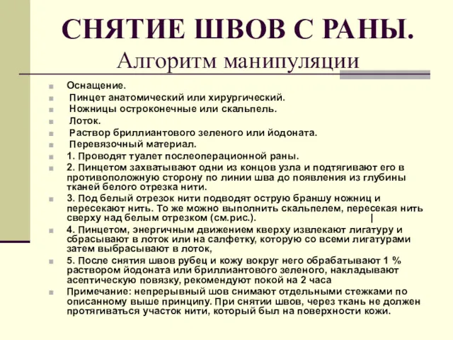 СНЯТИЕ ШВОВ С РАНЫ. Алгоритм манипуляции Оснащение. Пинцет анатомический или