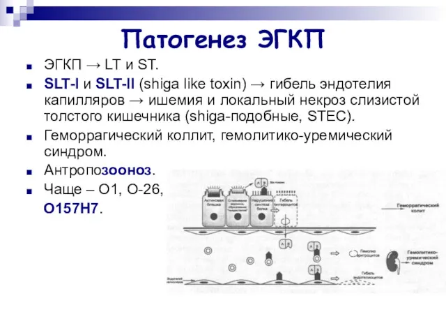 Патогенез ЭГКП ЭГКП → LT и ST. SLT-I и SLT-II