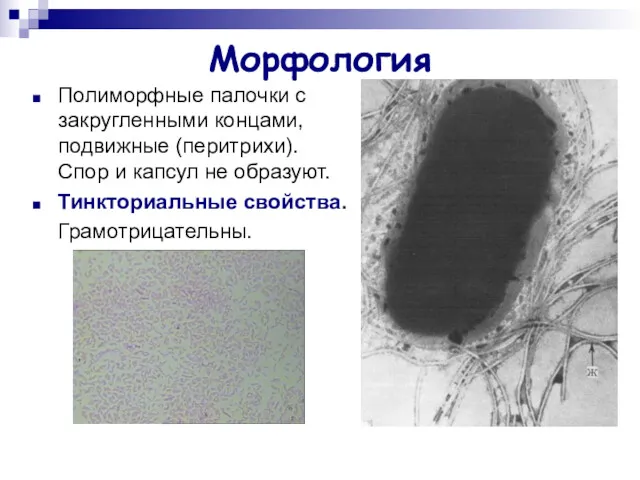 Морфология Полиморфные палочки с закругленными концами, подвижные (перитрихи). Спор и капсул не образуют. Тинкториальные свойства. Грамотрицательны.