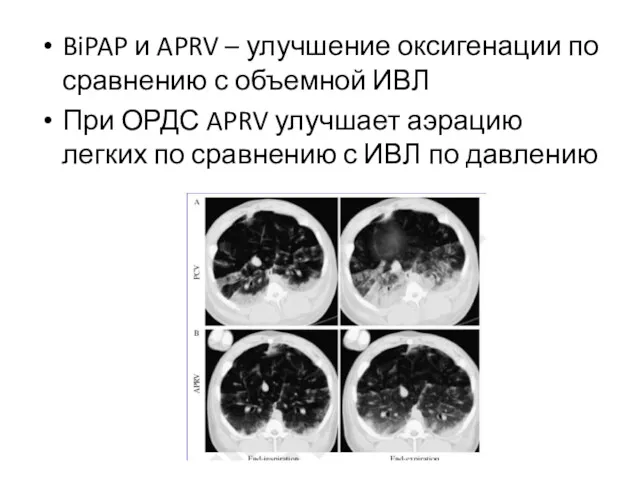 BiPAP и APRV – улучшение оксигенации по сравнению с объемной